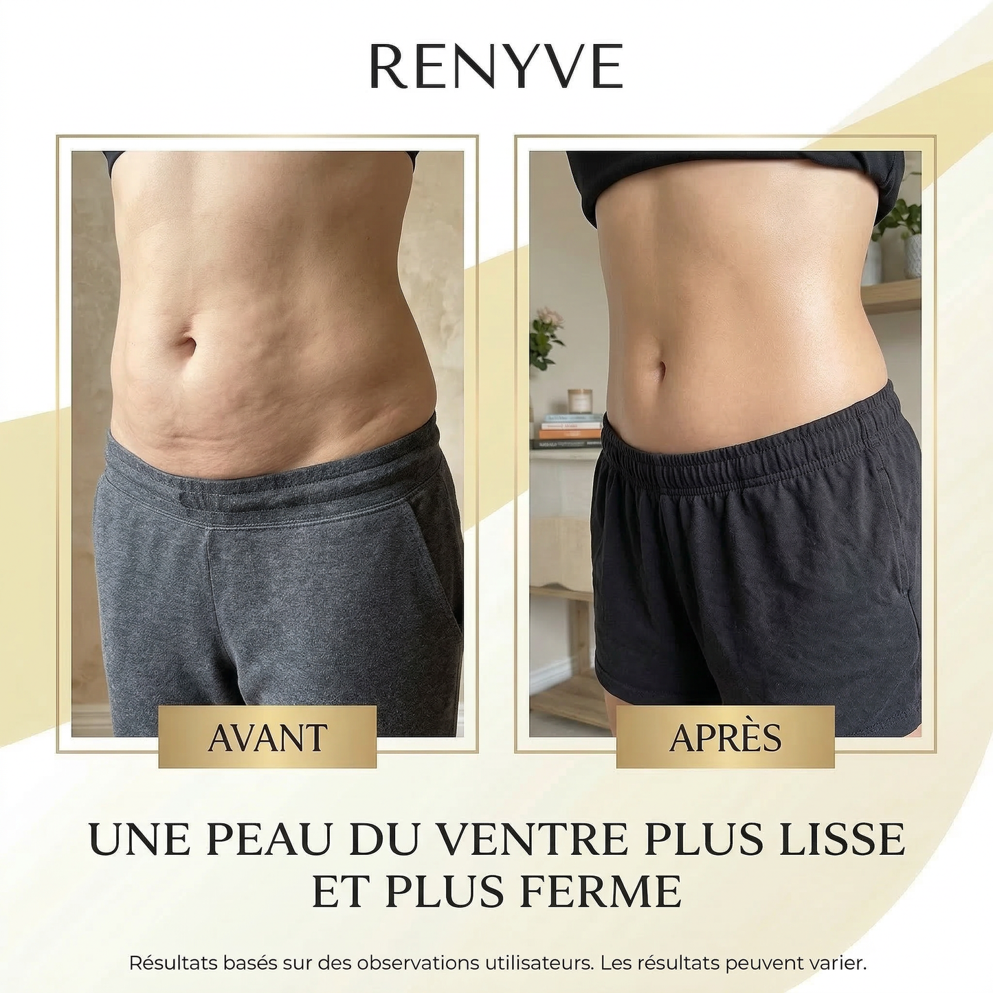 Huile Anti-Cellulite Raffermissante 240ml | 12 Actifs | RENYVE