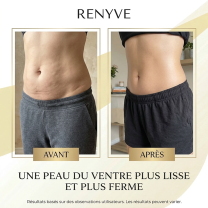 Huile Anti-Cellulite Raffermissante 240ml | 12 Actifs | RENYVE