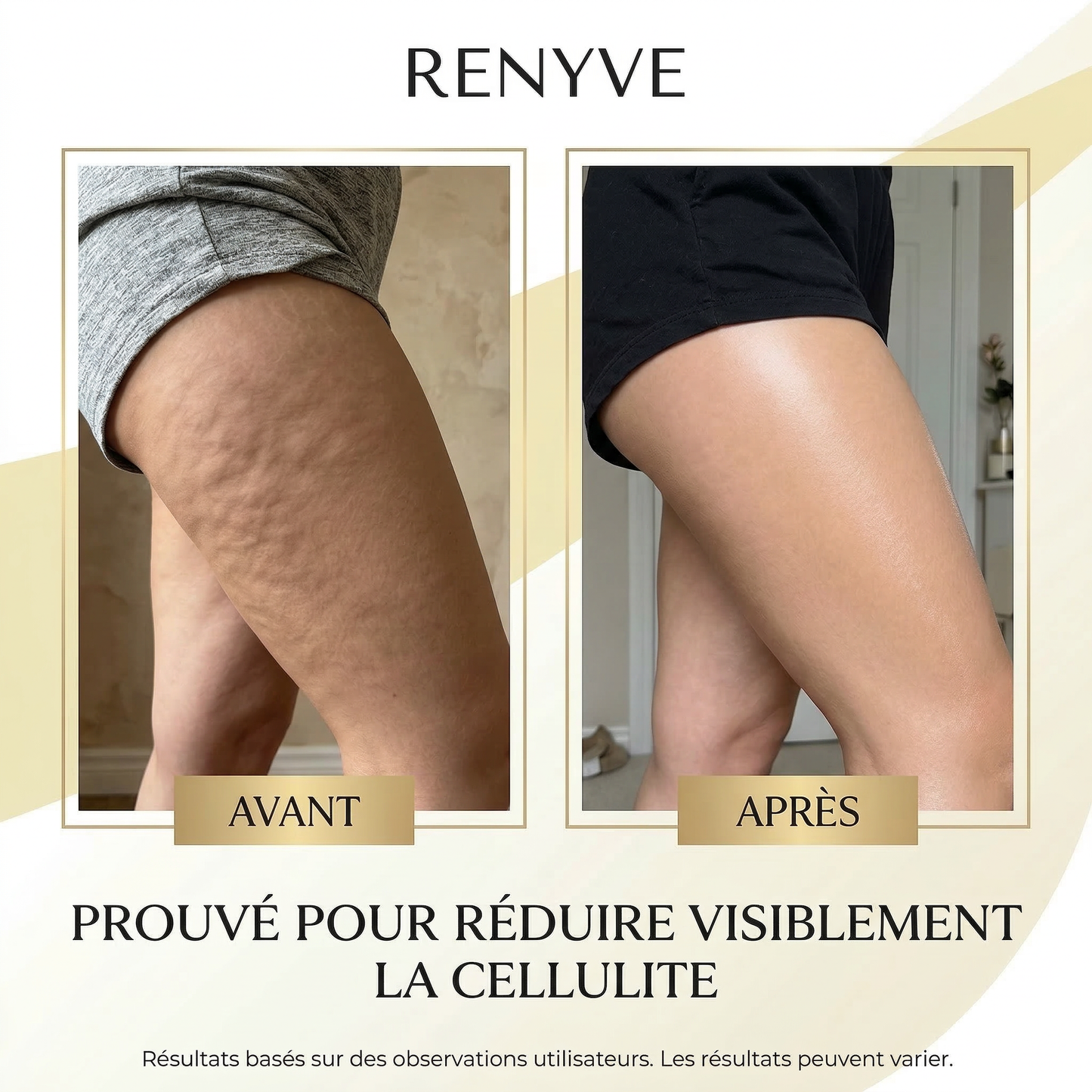 Huile Anti-Cellulite Raffermissante 240ml | 12 Actifs | RENYVE