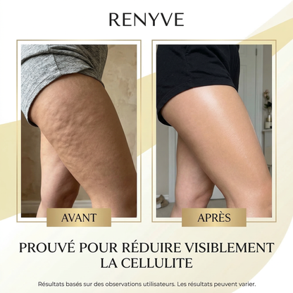 Huile Anti-Cellulite Raffermissante 240ml | 12 Actifs | RENYVE