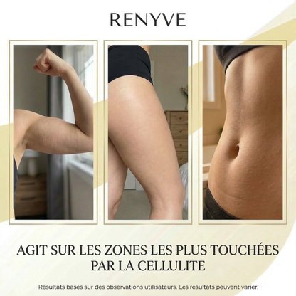 Huile Anti-Cellulite Raffermissante 240ml | 12 Actifs | RENYVE