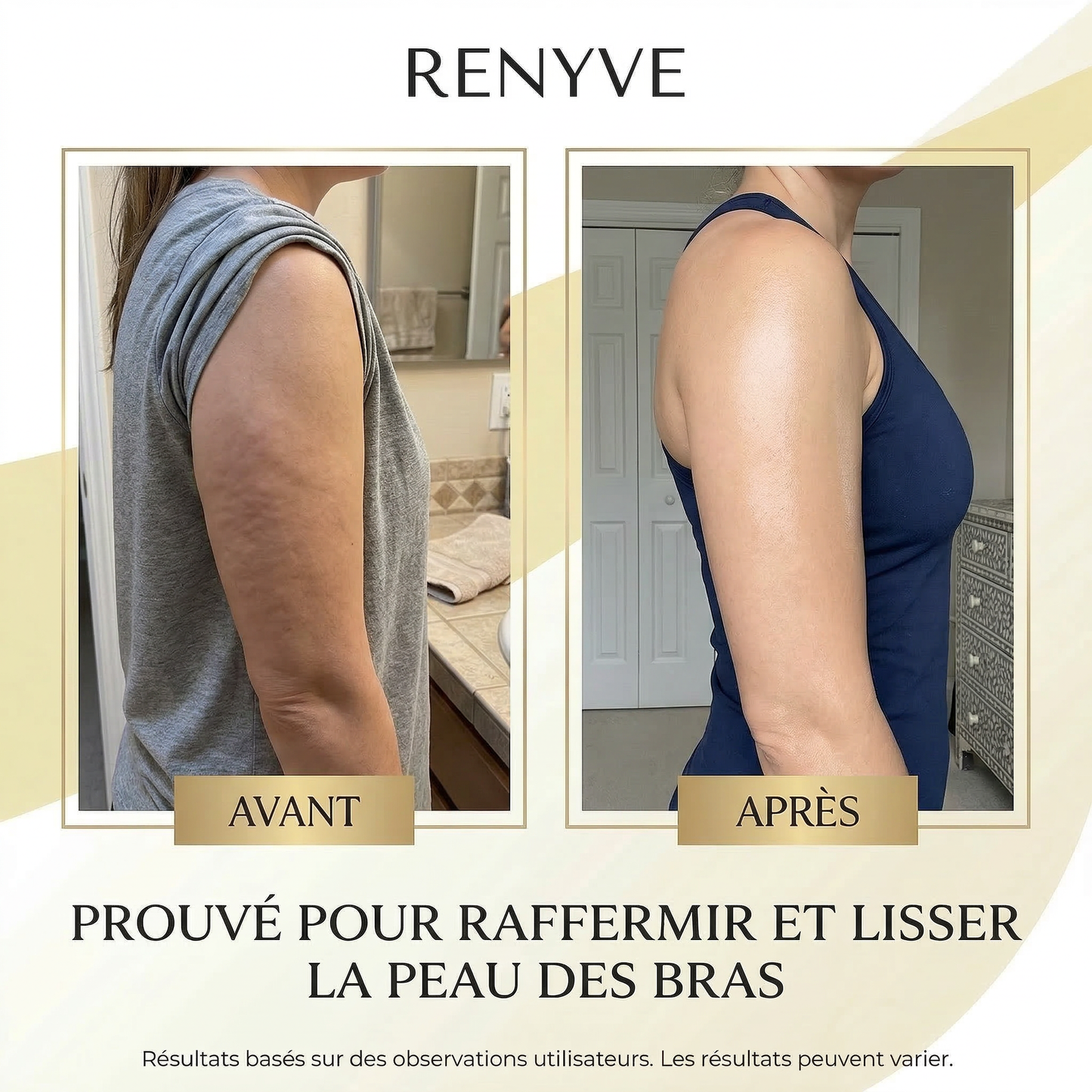 Huile Anti-Cellulite Raffermissante 240ml | 12 Actifs | RENYVE