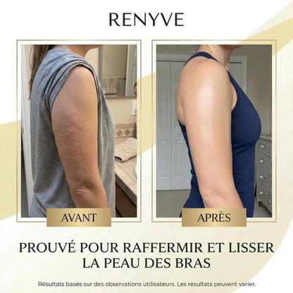 Huile Anti-Cellulite Raffermissante 240ml | 12 Actifs | RENYVE