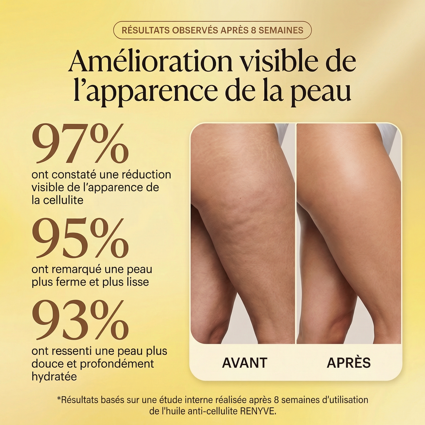 Huile Anti-Cellulite Raffermissante 240ml | 12 Actifs | RENYVE