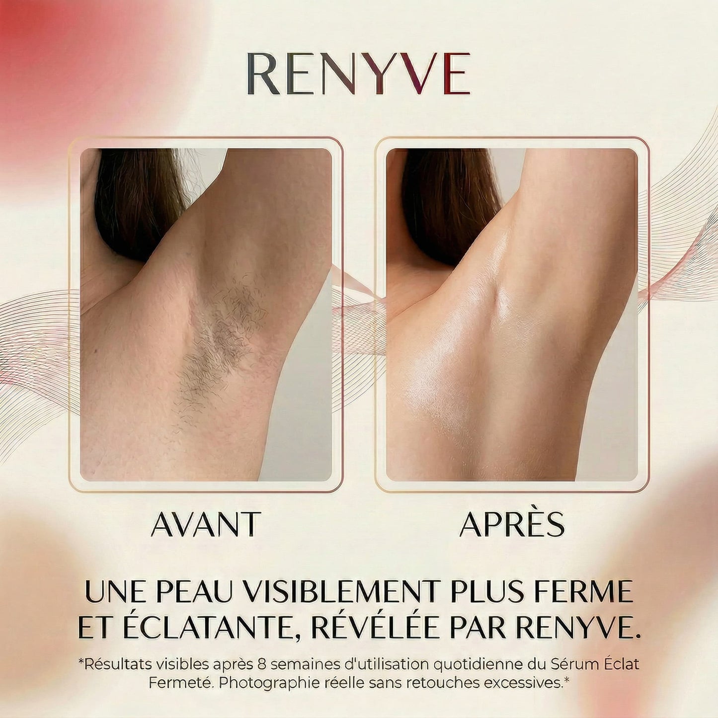 Huile Anti-Repousse Des Poils • 9 Actifs • 60ml | RENYVE