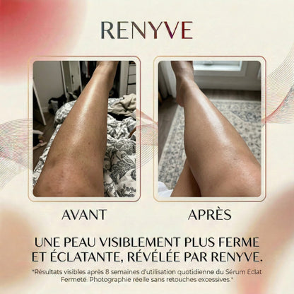 Huile Anti-Repousse Des Poils • 9 Actifs • 60ml | RENYVE