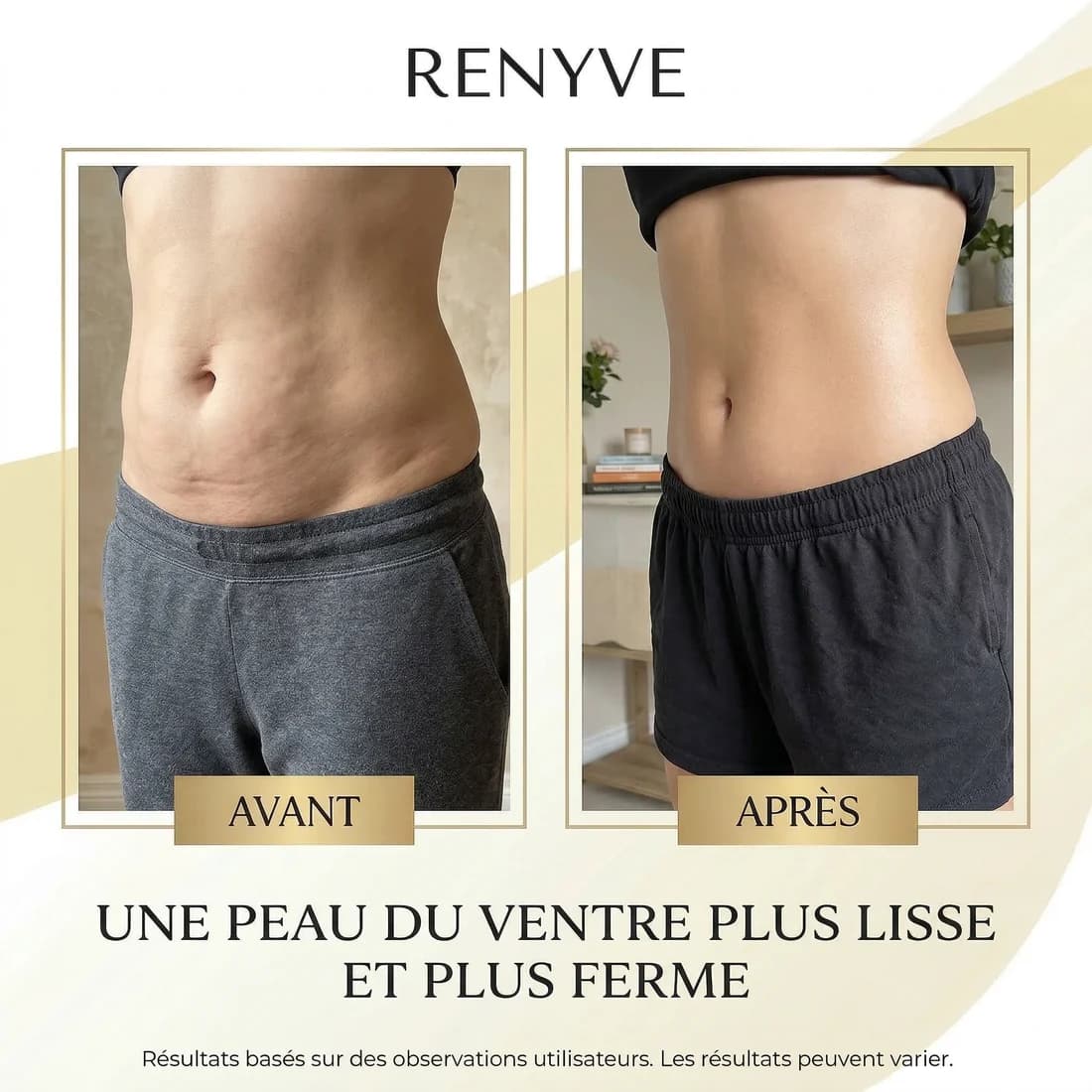 Huile Anti-Cellulite Raffermissante •11 Actifs • 240ml | RENYVE