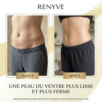 Huile Anti-Cellulite Raffermissante •11 Actifs • 240ml | RENYVE