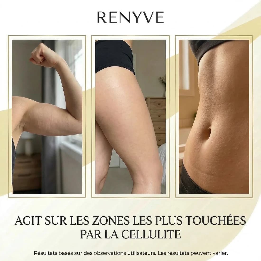 Huile Anti-Cellulite Raffermissante •11 Actifs • 240ml | RENYVE