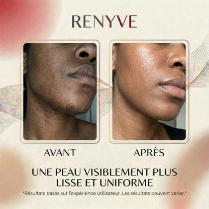 Huile Anti-Repousse Des Poils • 9 Actifs • 60ml | RENYVE